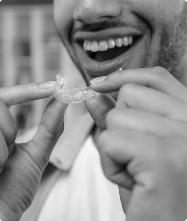 Quels sont les avantages des aligneurs ?